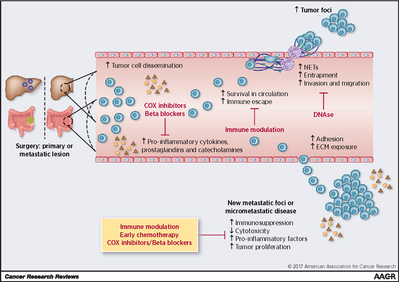 Figure-1-Cancer-metastasis