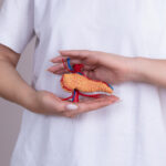 Chemotherapie bei Pankreaskarzinomen